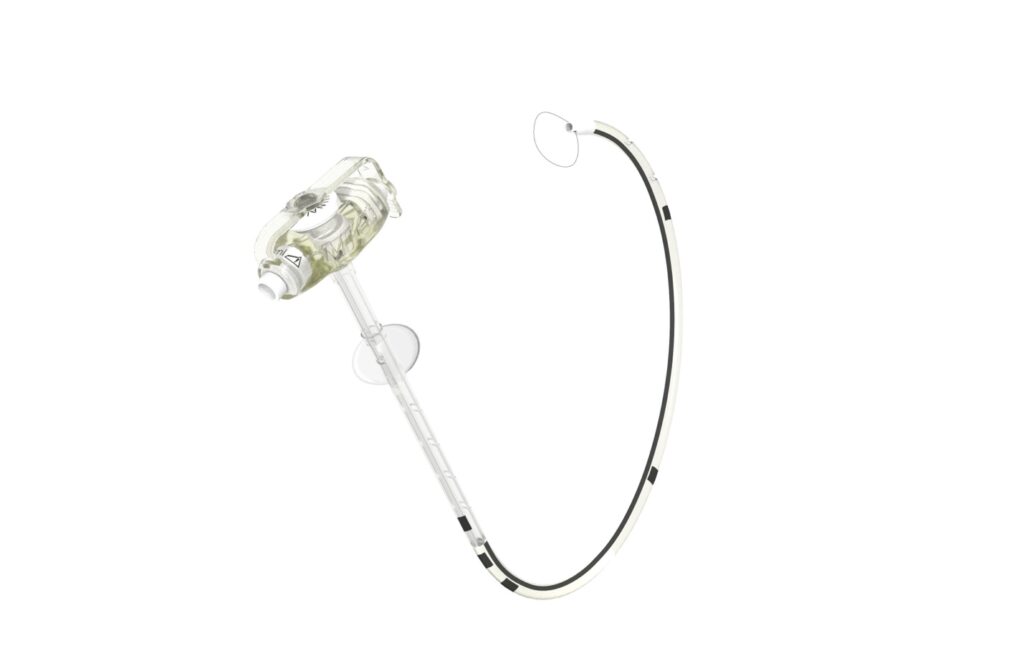Sondes d’alimentation de gastro-jéjunostomie MIC-KEY*
