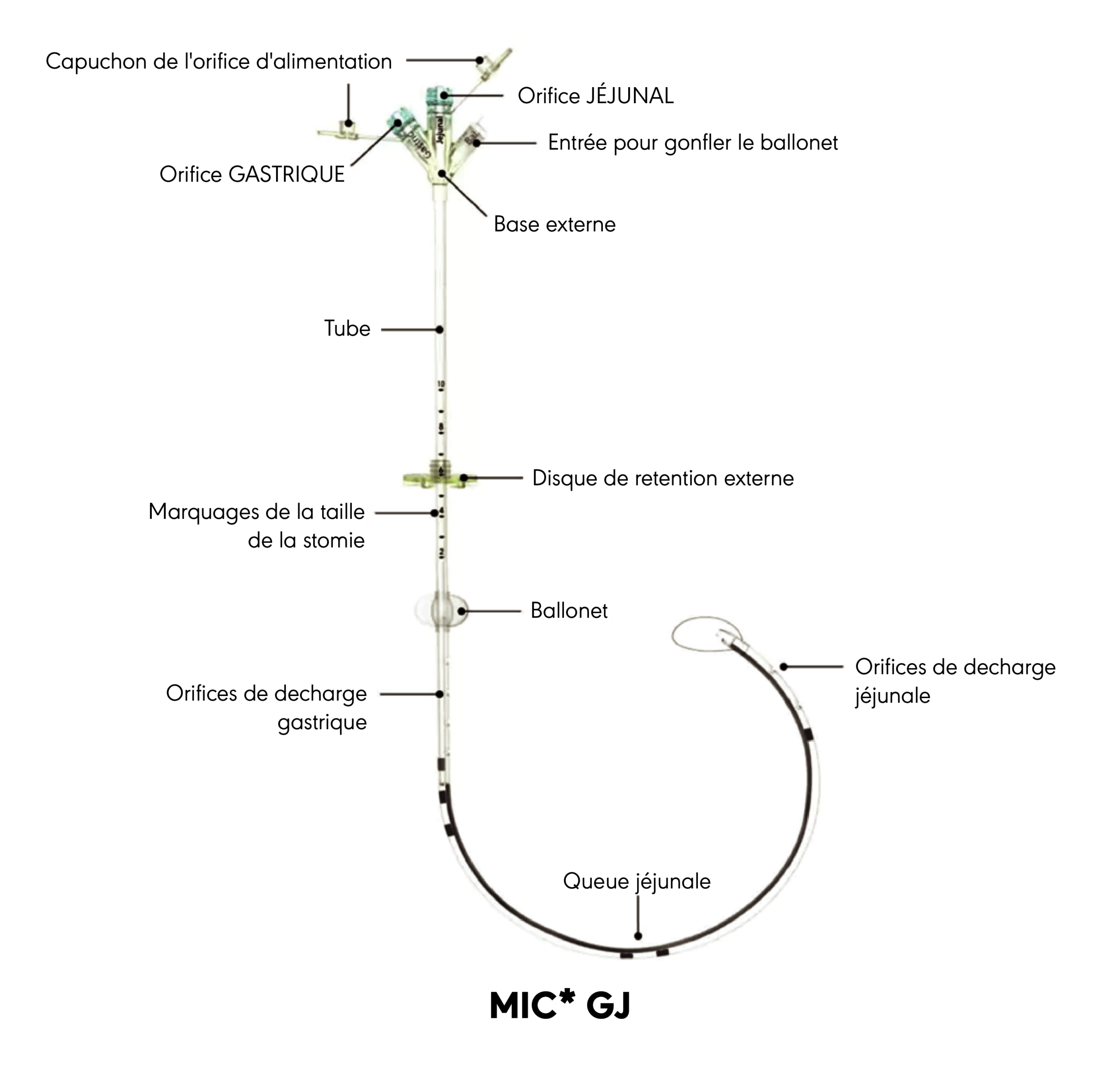 Schéma produit de la sonde de gastro-jéjunostomie MIC*