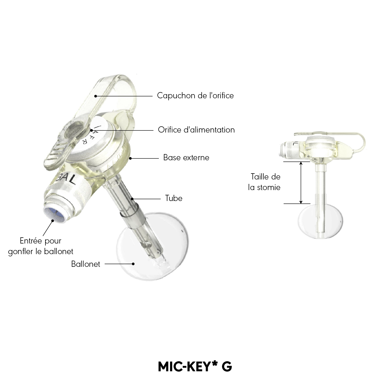 Schéma produit de la sonde de gastrostomie MIC-KEY*