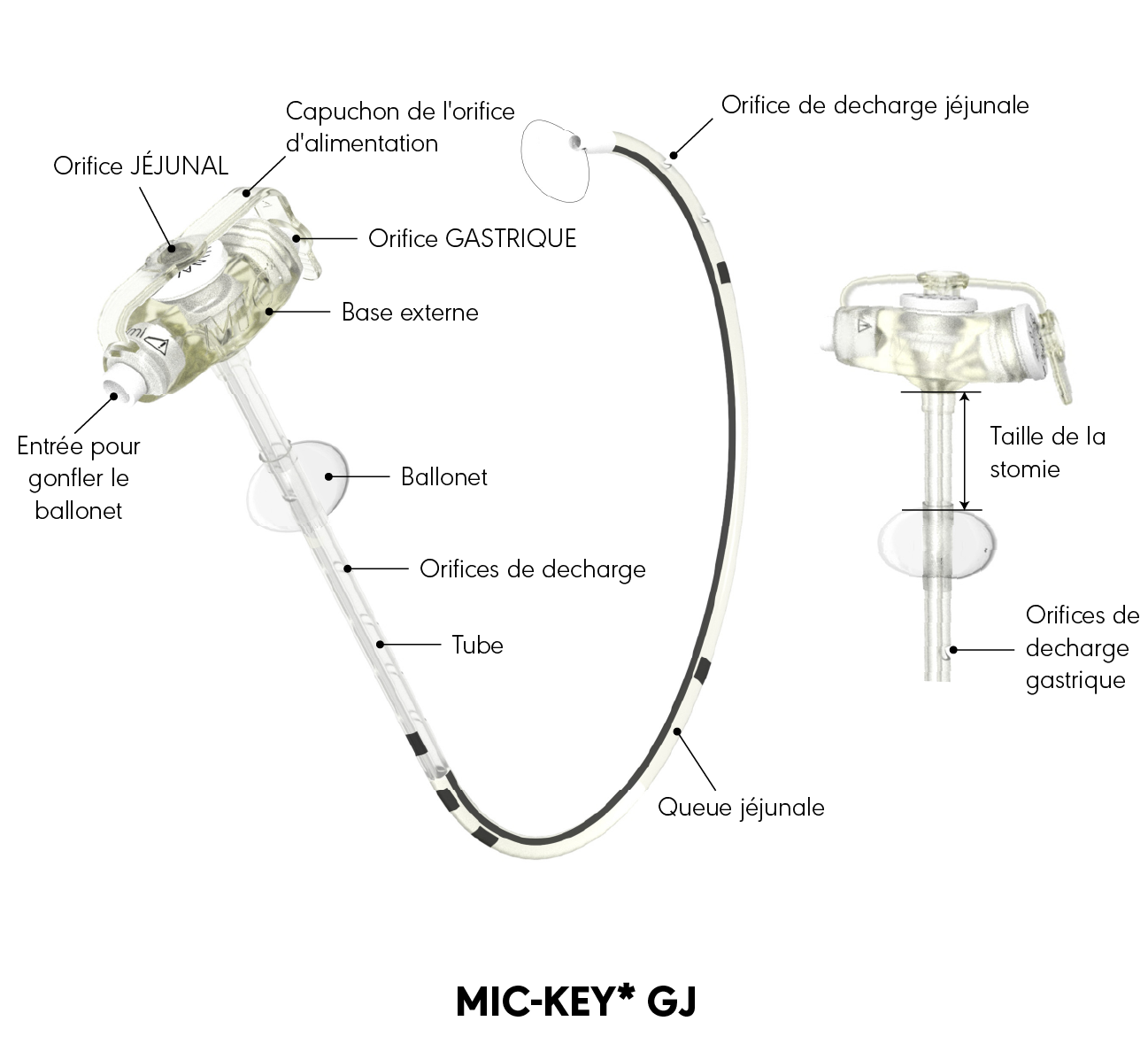 Schéma produit de la sonde de gastro-jéjunostomie MIC-KEY*
