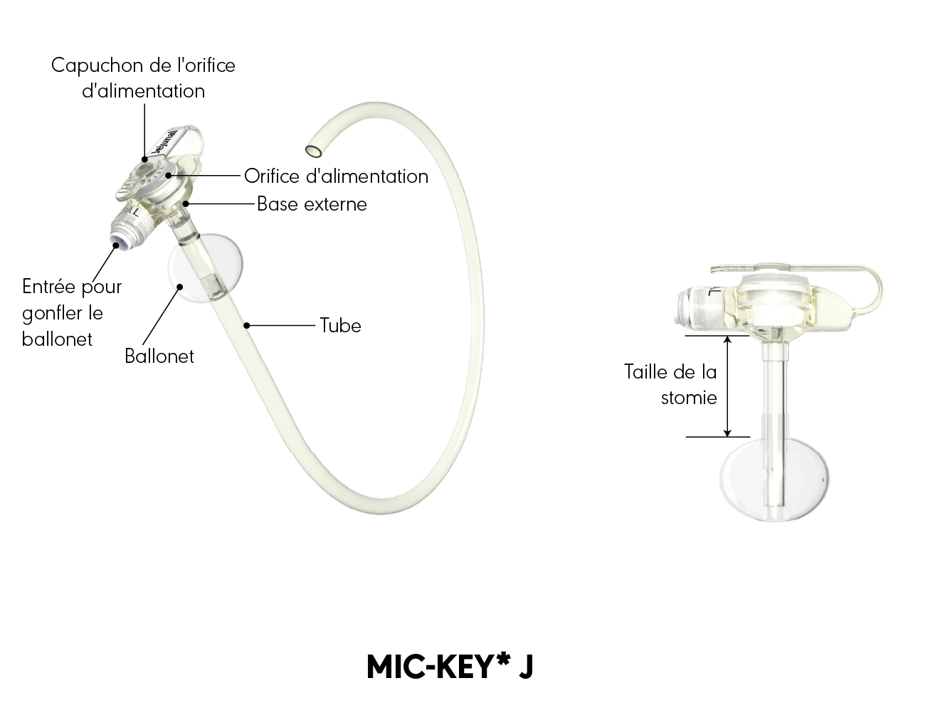 Schéma produit de la sonde de jéjunostomie MIC-KEY*