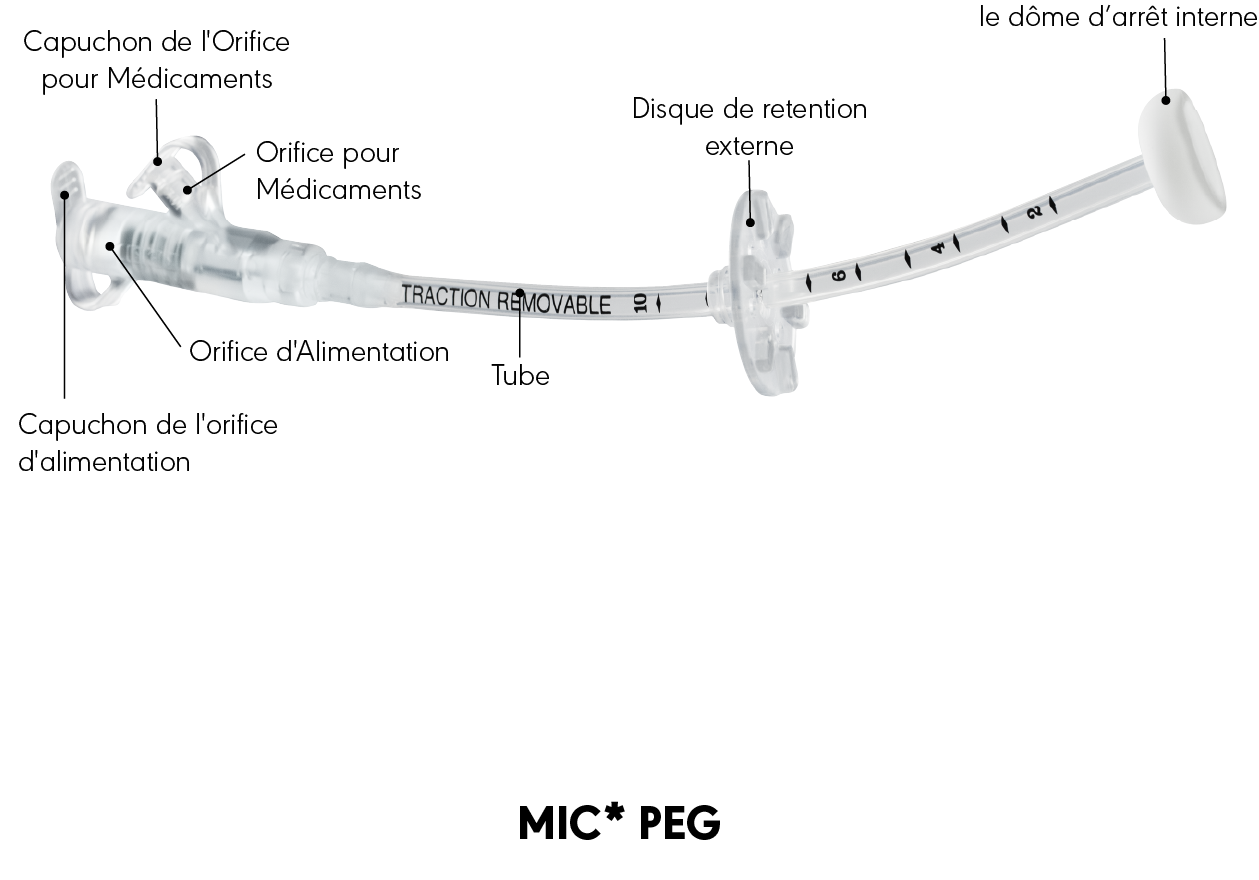 Schéma produit de la sonde de gastrostomie percutanée endoscopique MIC*